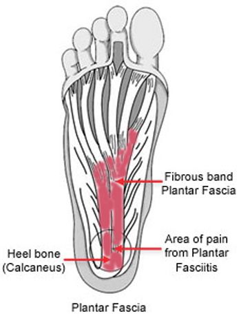 Plantar fascia