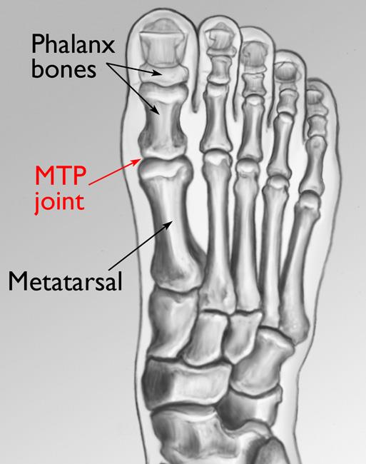 Normal foot anatomy