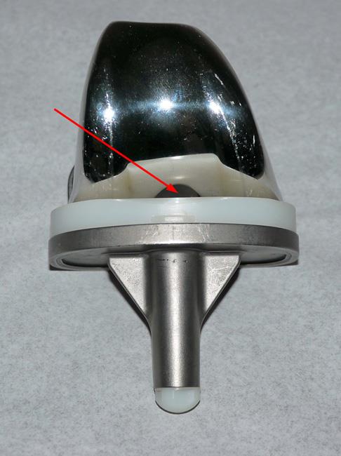 Cruciate-retaining component