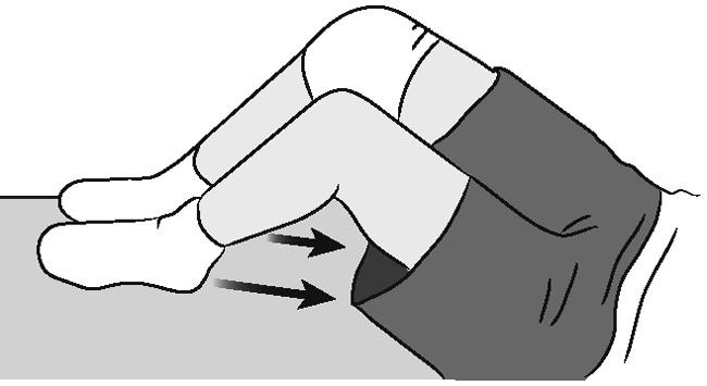 Hamstring contraction