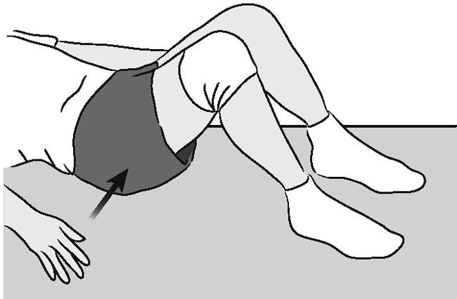 Buttock tucks
