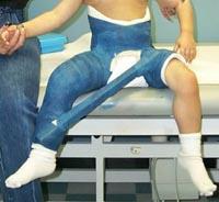 Child in hip spica cast