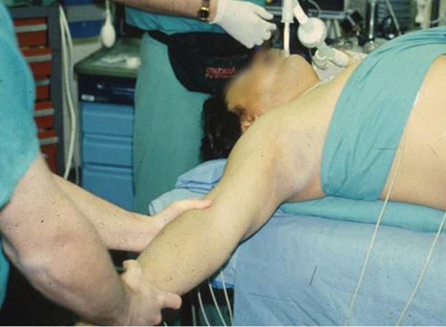 closed reduction of SC joint injury